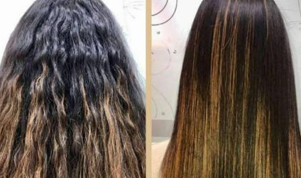 Comparacion entre la cirugia capilar y la queratina.