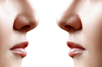 articulo sobre la rinoplastia. Imagen de referencia.